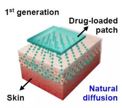 第一代透皮给药技术：通过药物的自然扩散.jpg