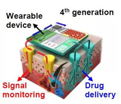 第四代透皮给药技术：在可穿戴设备的帮助下，用于患者定制治疗.jpg
